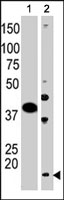 PAB2435 - SUMO2