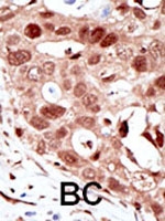 PAB2435 - SUMO2