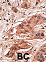 PAB2438 - Bcl-2-like 5