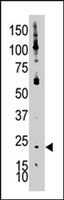 PAB2439 - Bcl-2-like 7