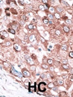 PAB2439 - Bcl-2-like 7