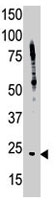 PAB2442 - BID