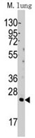 PAB2442 - BID