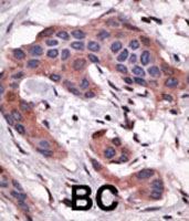 PAB2442 - BID