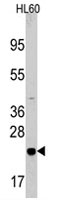 PAB2447 - Bcl-2-like 8