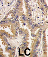 PAB2447 - Bcl-2-like 8
