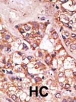 PAB2449 - BIK