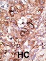 PAB2450 - Bcl-2-like 8