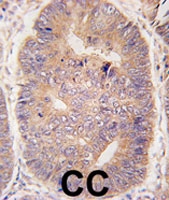 PAB2454 - TASP1