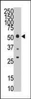 PAB2455 - HTRA1 / PRSS11