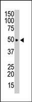 PAB2456 - HTRA1 / PRSS11