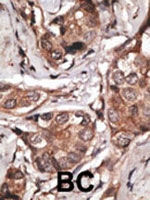 PAB2456 - HTRA1 / PRSS11