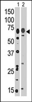 PAB2462 - HSPA5 / GRP78