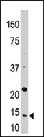 PAB2465 - Thioredoxin / TRX1