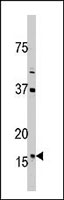 PAB2468 - Thioredoxin-2 / TRX2