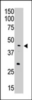 PAB2470 - APOBEC3G