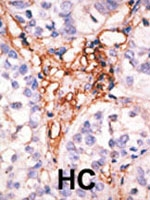PAB2470 - APOBEC3G
