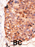 PAB2472 - APOBEC3G