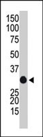 PAB2473 - APOBEC1