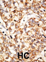 PAB2473 - APOBEC1