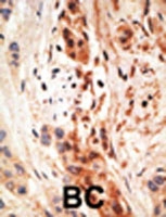 PAB2475 - APOBEC3A