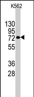 PAB2479 - DDX4
