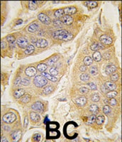 PAB2486 - NANOS1