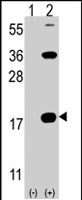 PAB2494 - CD247 / CD3Z