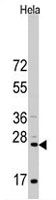 PAB2495 - CD8