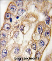 PAB2496 - CD8