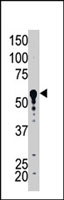 PAB2501 - SPTLC1