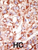 PAB2502 - ACSL3