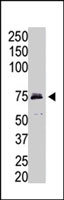 PAB2504 - ACSL4