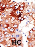 PAB2504 - ACSL4