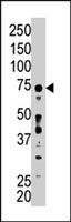 PAB2506 - ACSL6