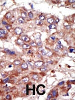 PAB2506 - ACSL6