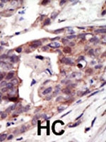 PAB2507 - PPT1 / PPT