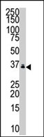 PAB2508 - PPT1 / PPT
