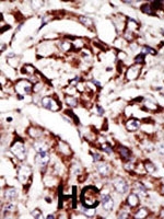 PAB2508 - PPT1 / PPT