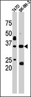 PAB2513 - ICMT / PCCMT