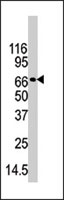 PAB2519 - PADI4