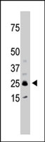 PAB2526 - SULT1C2 / SULT1C1