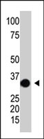 PAB2528 - SULT2A1 / HST
