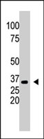 PAB2532 - SULT1A1