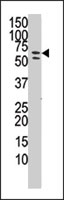 PAB2534 - PAPSS1