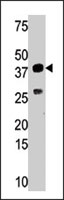 PAB2536 - SULT1C4 / SULT1C2