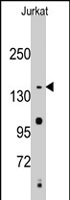 PAB2537 - SMC2 / CAPE