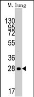 PAB2538 - Cyclin D1