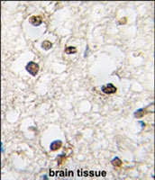 PAB2543 - QKI / Protein quaking