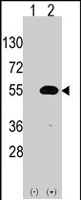 PAB2545 - NR0B1